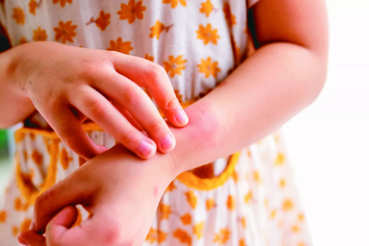 我們是自作自受嗎？ 探討現代生活型態與過敏的關係