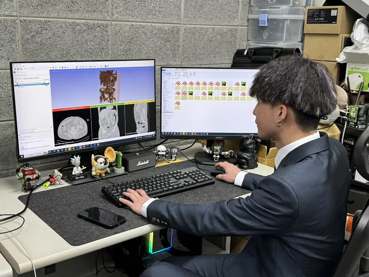 元智攜 AI 進攻醫療  急性闌尾炎提升診斷速度