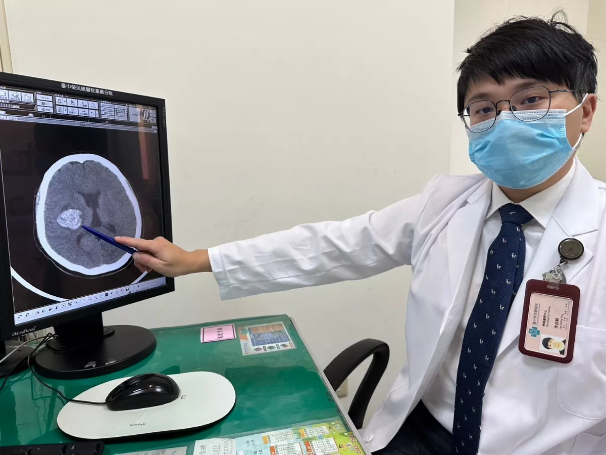 年輕女子腦出血 微創手術神救援