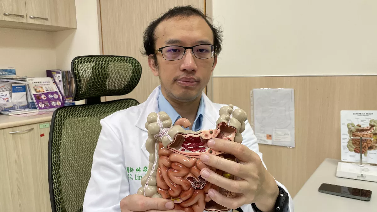 光摸肚皮就痛 6旬男憩室炎併發腸穿孔