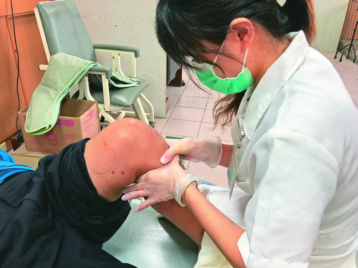 微型感測器 助攻復健療程