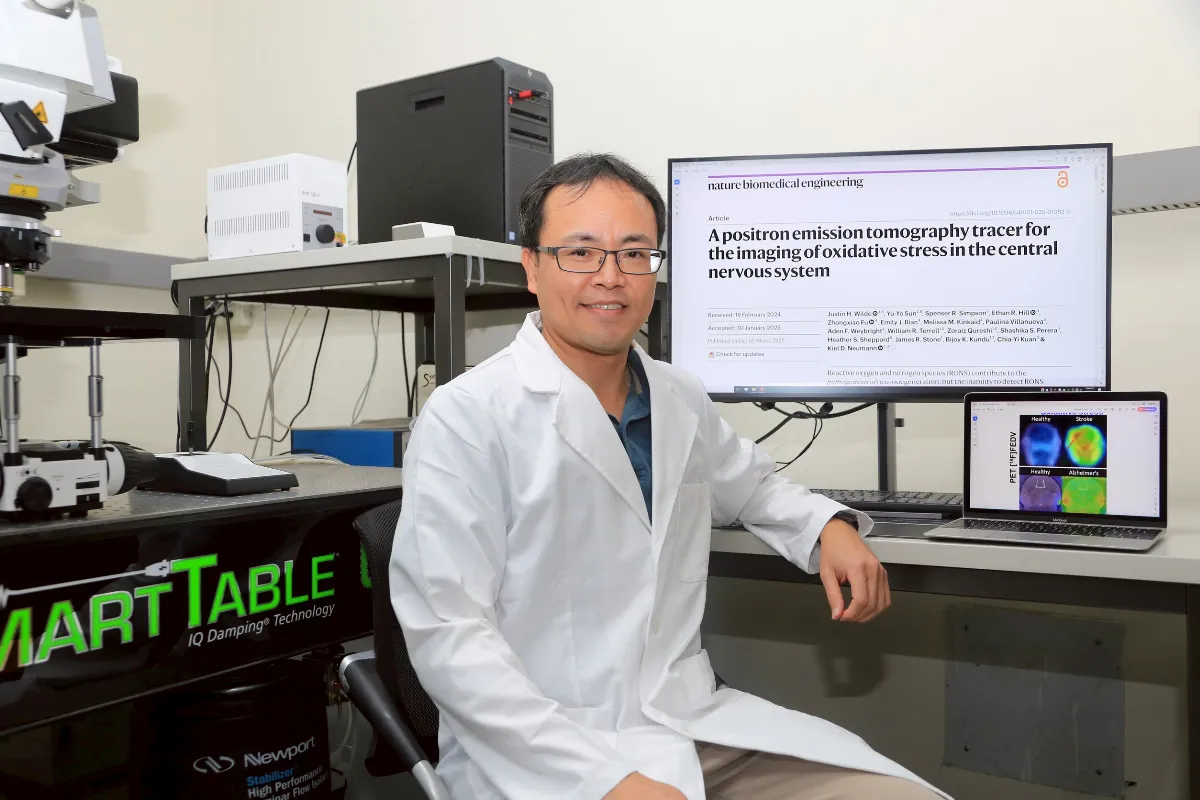 創新氧化壓力偵測技術 有望緩解阿茲海默症