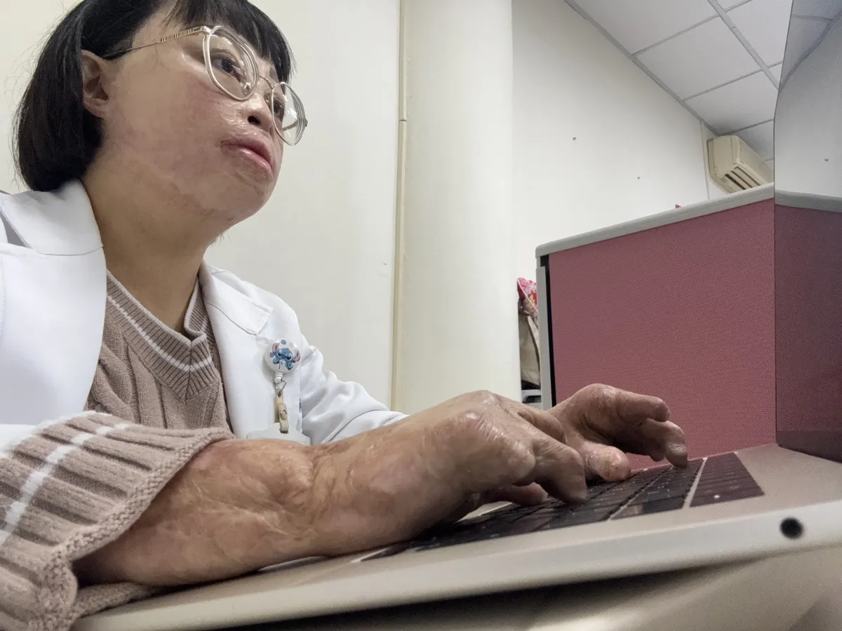 火災倖存者成社工師 失弟心痛至今難癒