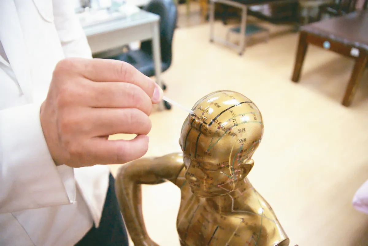 失智症不可逆 中醫針灸助延緩退化