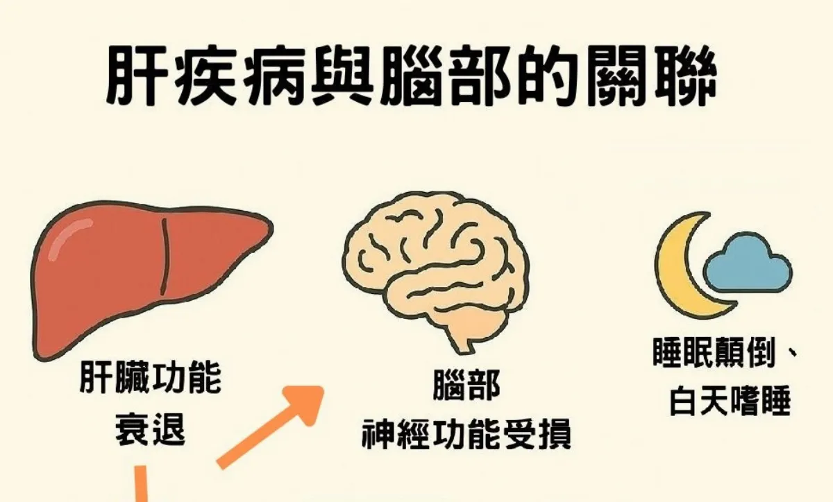 當心肝炎惡化 猛爆性肝炎還會造成腦傷