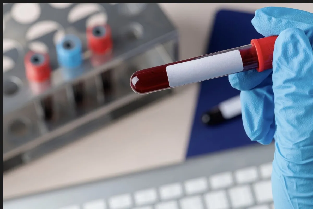 控制好三高 免致血管壁鈣化硬如大理石  