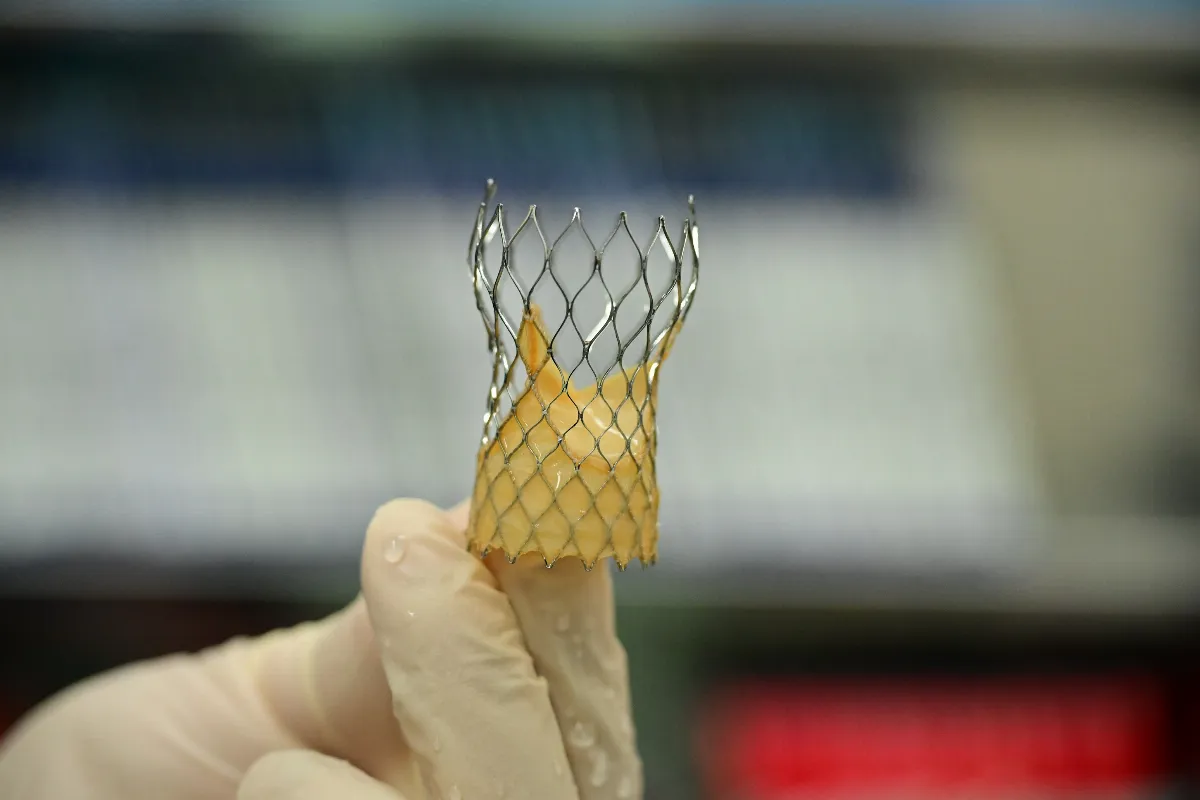 洗腎翁主動脈狹窄復發 TAVI手術助重生