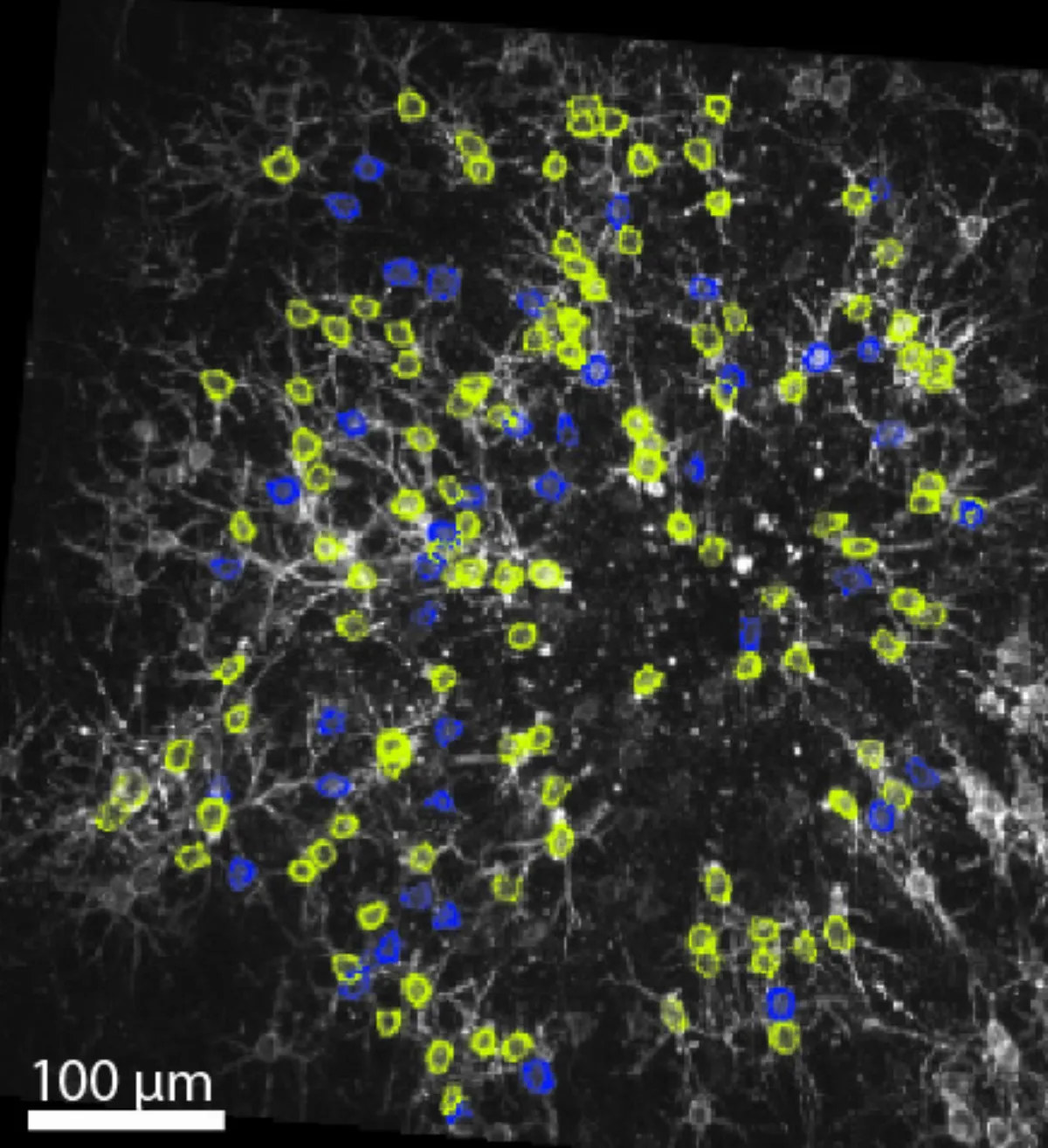 精準定位神經活動訊號  陽明交大揭大腦運作之謎