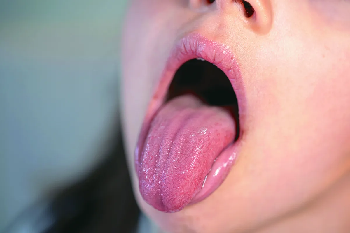 中醫望舌識病