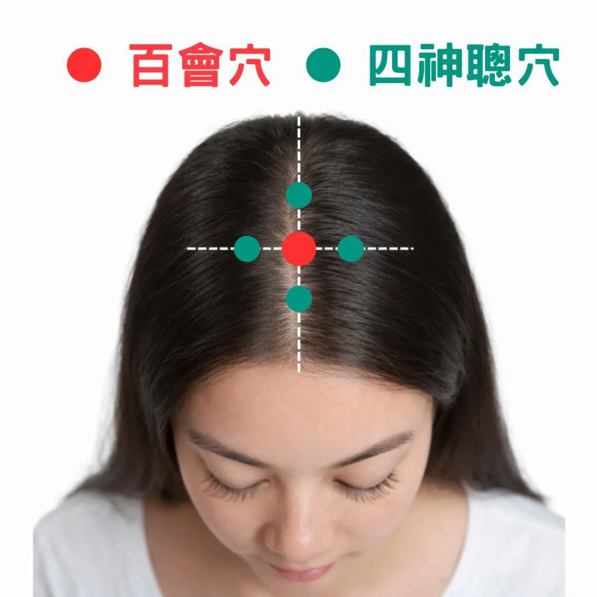 中年婦失眠七年 中醫疏肝理氣助整夜好眠