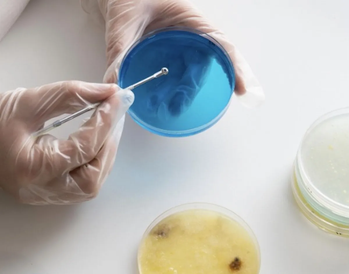 無症狀老婦篩檢出5公分腸癌 微創手術隔日出院