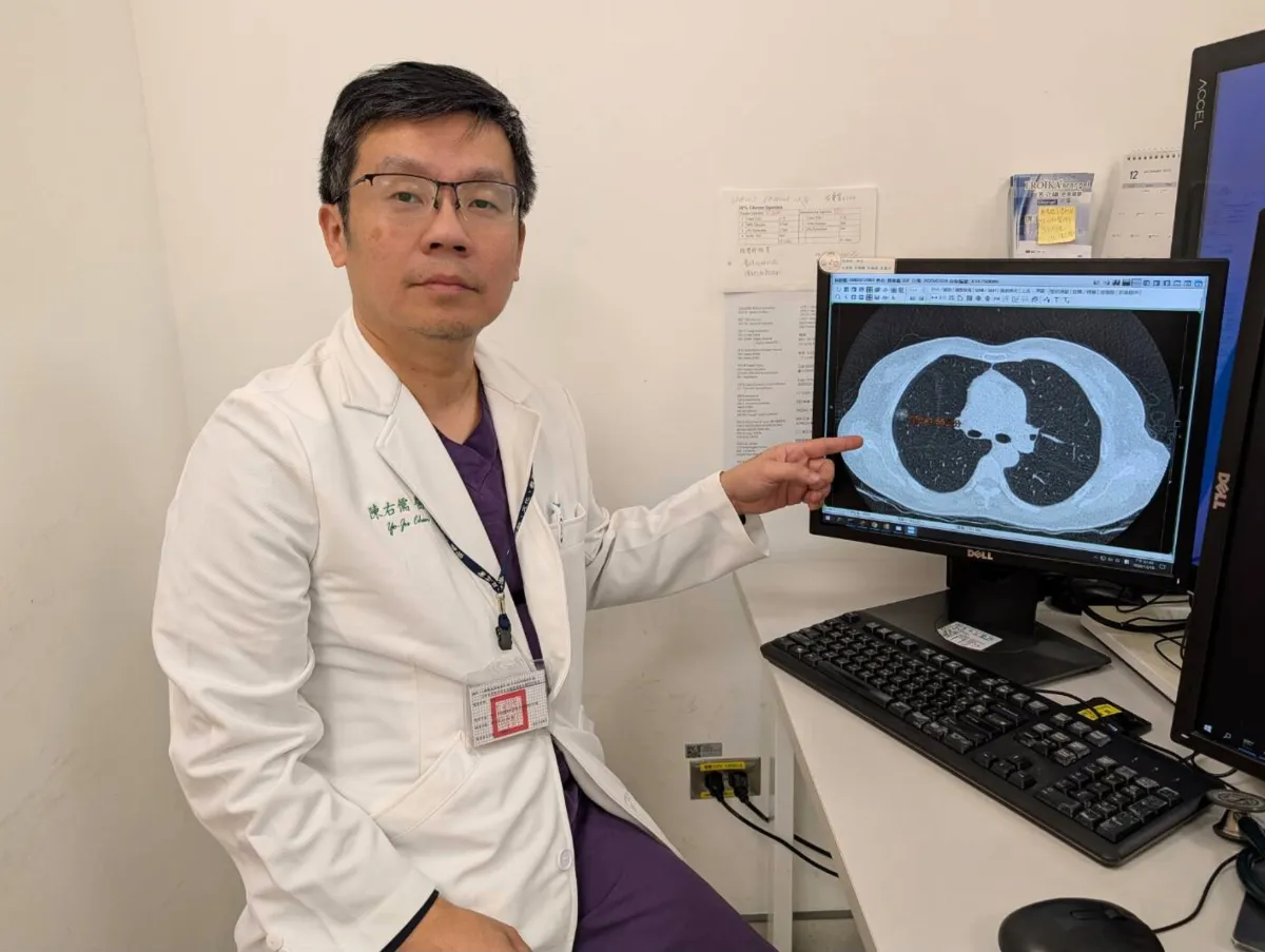 肺癌無聲上門 姊妹篩檢揪出早期癌