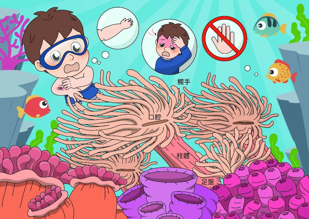 海洋中毒美人 海葵