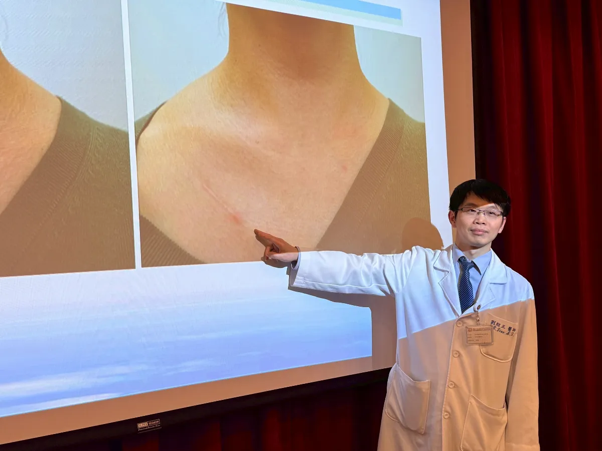 達文西雷射助攻 精準甲狀腺手術