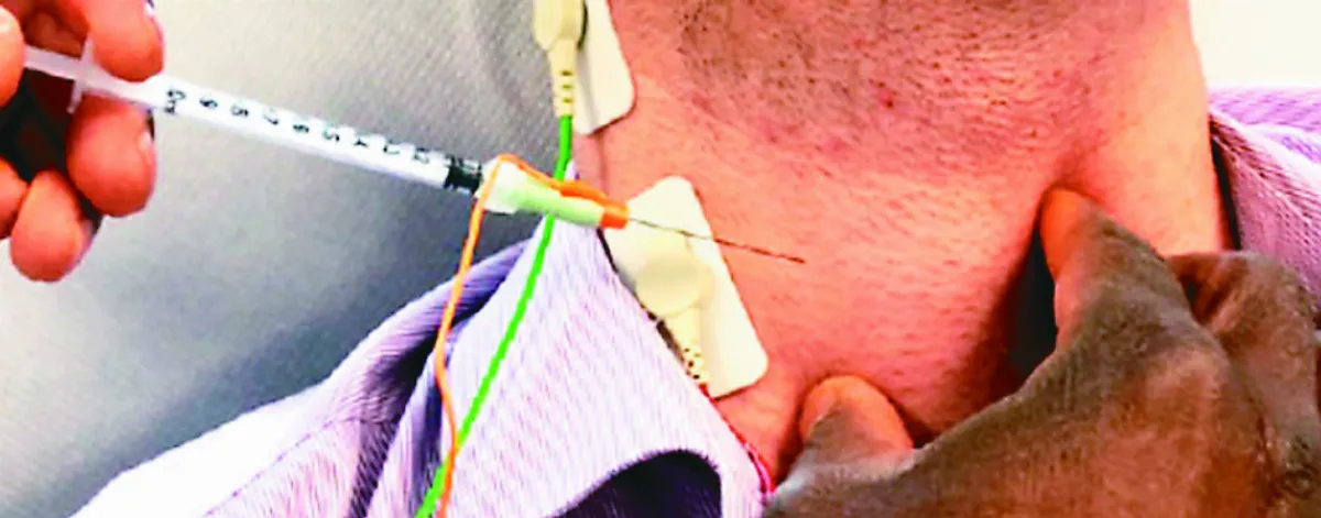 分子水凝膠 讓受損聲帶再生