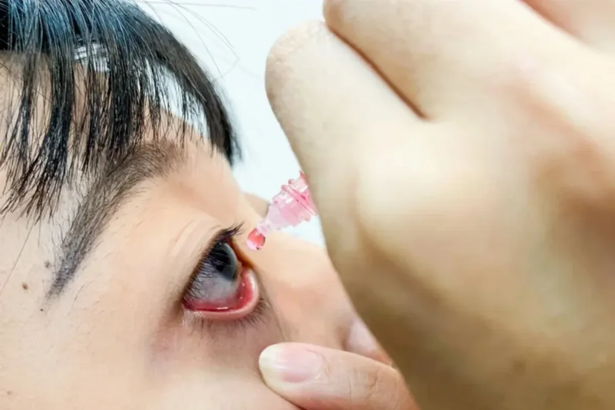 眼藥水直接滴入眼恐傷角膜？ 藥師揭正解：順序錯了等於白點