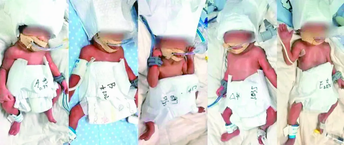 24歲婦誕下5胞胎 機率6000萬分之1