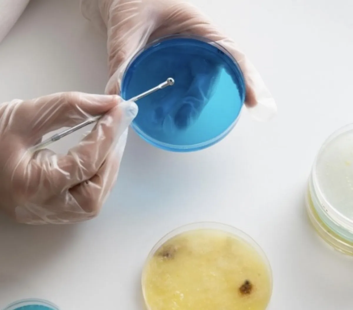 免做大腸鏡就能判斷 糞便鈣衛蛋白揪出腸道發炎