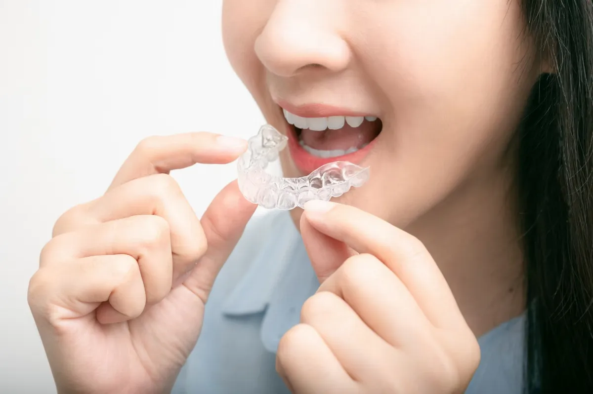 牙齒排齊卻冒黑縫 成人矯正黑三角真相